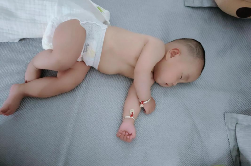 鞍山宝宝头上长痱子